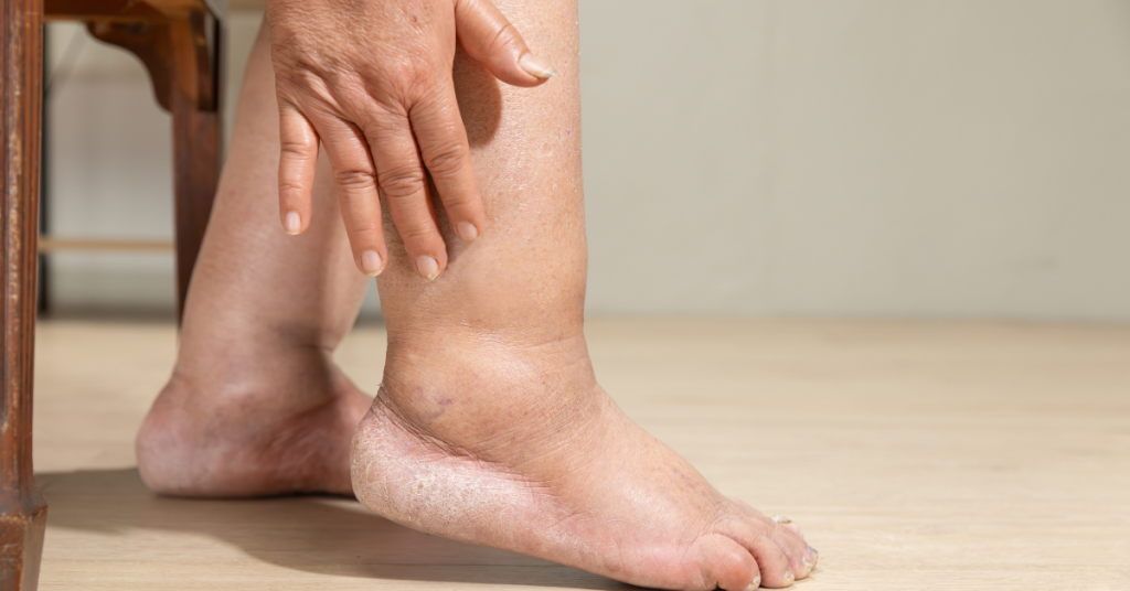 Quando procurar um cirurgião vascular