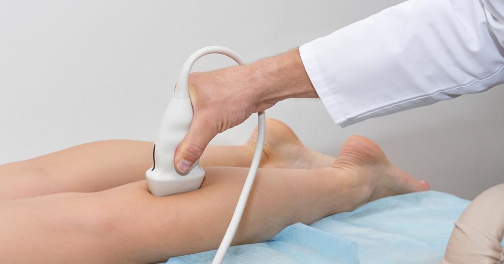 Exames vasculares: quais são e quando o cirurgião vascular solicita?